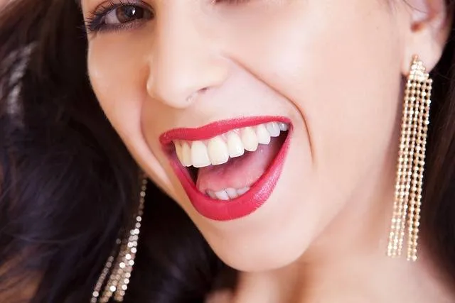 sourire dents blanches